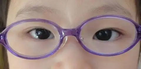 斜视弱视,双眼视觉异常诊疗新进展培训班通知