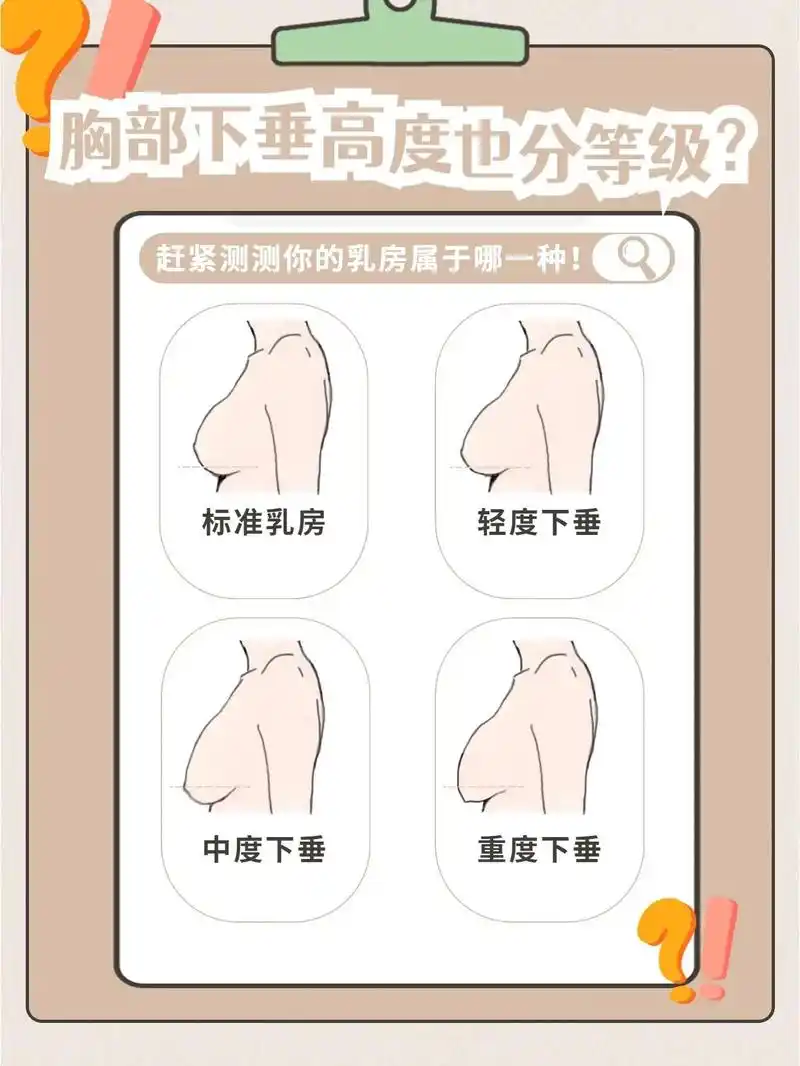 你在哪一级?#图文伙伴计划 什么?胸下垂 - 抖音