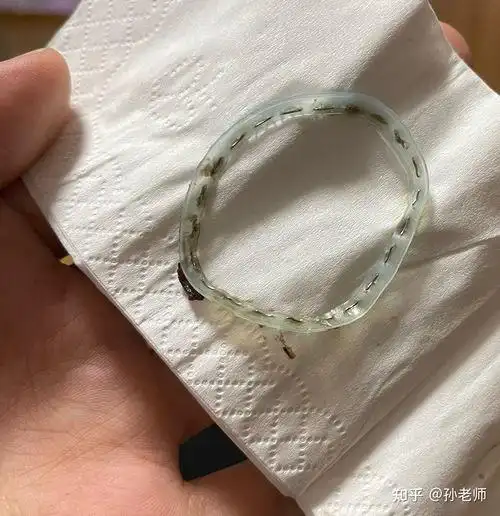 包皮环切后钉子多久脱落,环切手术钉子多久脱落完