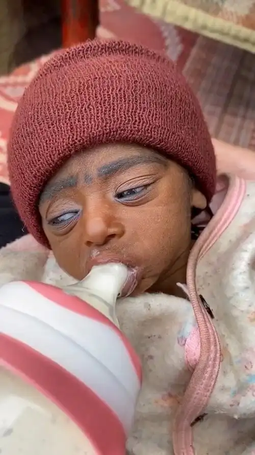 今天刷视频,看到这个黑人宝宝,莫名的好心疼96愿天下的孩子可以健康