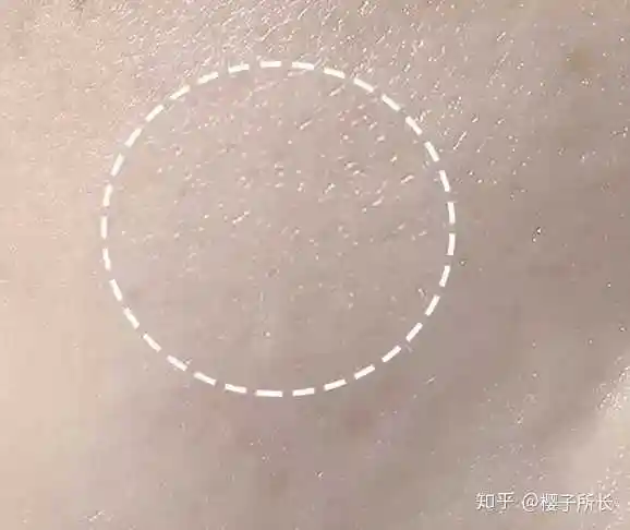 除了婴儿,正常人都是能看到毛孔的 (前方可能带来不适!