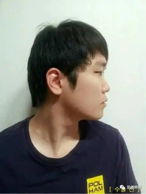 鼻梁陷 —— 没出息 鼻梁主事业运,如果男人的鼻梁陷,表示其事业运不