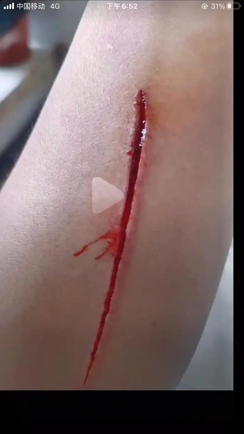 胸口的伤口永远比身上的伤口痛,凭什么又来一次刺激我,#有谁懂 - 抖音