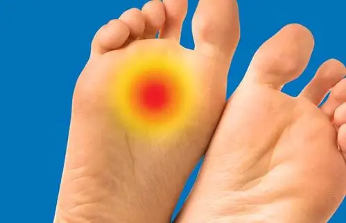 前足底疼痛( 跖痛症)的诊断和治疗