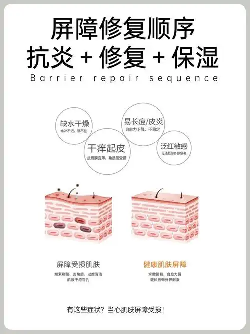 皮肤屏障受损修复指南