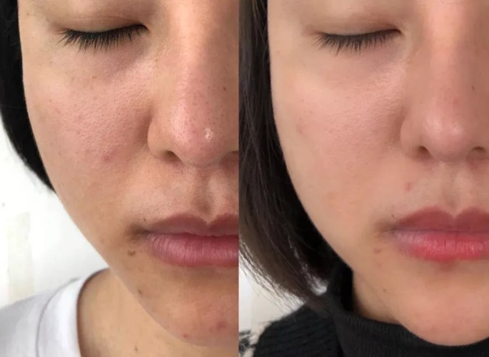 性价比高--整容级的护肤品!