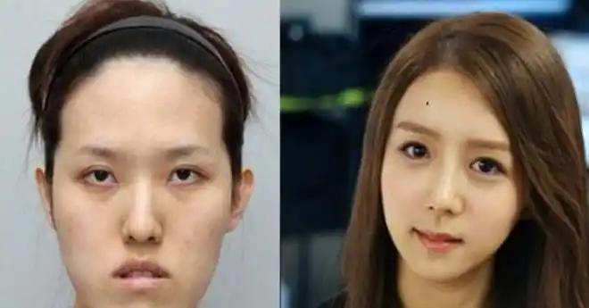 12岁女童三年整容60次花费将近上百万现状令人唏嘘