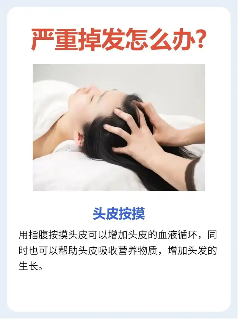 严重掉发该怎么办呢?掉发是一种常见的现代生活中的问题.