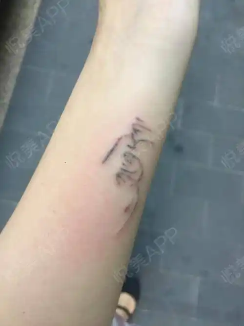 因为没有洗纹身的经历,在网上看那些洗纹身的很可怕,怕洗.