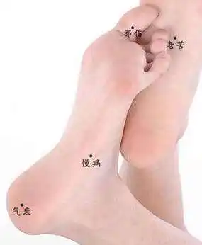 哪里长痣不好,哪些地方长的是恶痣?