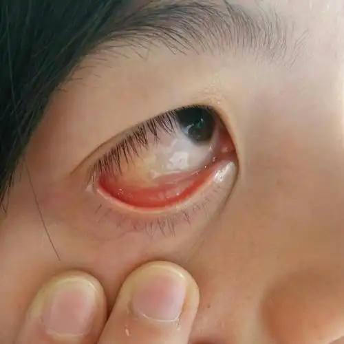 很害怕 求相关从业人士解答!