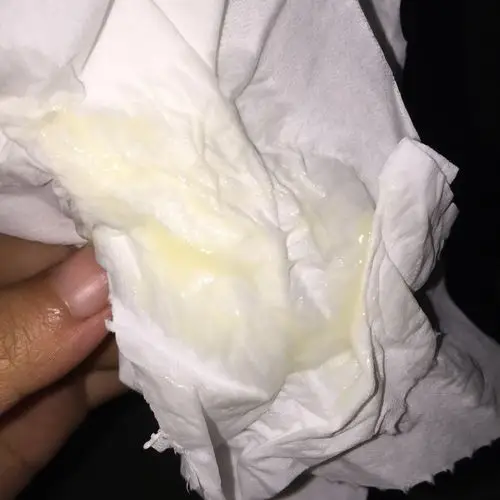 白带这样是不是有问题?闻着也没异味啊,也不痒