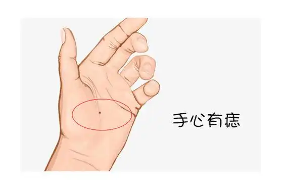 右手手心长痣代表什么?