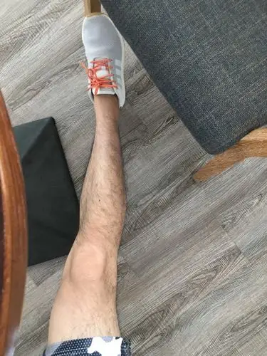 男生的腿毛应该怎么打理