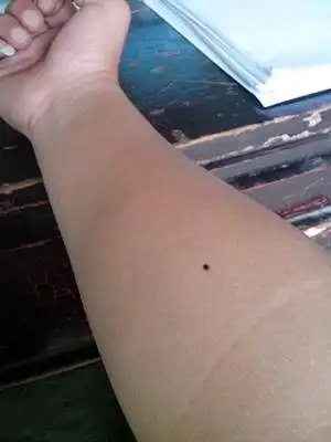 手臂内侧有痣代表了个人的恒心及忍受压力的能力,忍耐力极大,上司委派