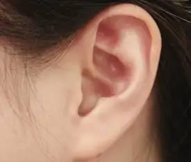 理想而美的耳朵外形给人以美的感觉,耳廓在头颅两侧对称生长,处于标准