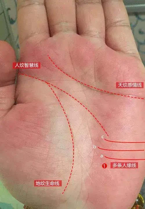 最明显的当属手上的人缘线,人缘线是起始于手掌月丘之掌沿,向掌心发展
