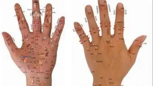 手背上有痣代表什么 手背有痣好吗