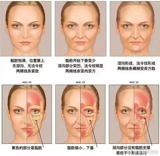 面部软组织由皮肤,浅层脂肪系统,肌肉,深层脂肪垫系统,骨膜颅骨五层