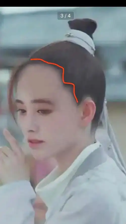 鞠婧祎真实发际线曝光网友p掉其发际线粉露出大脑门后与刚出道很像