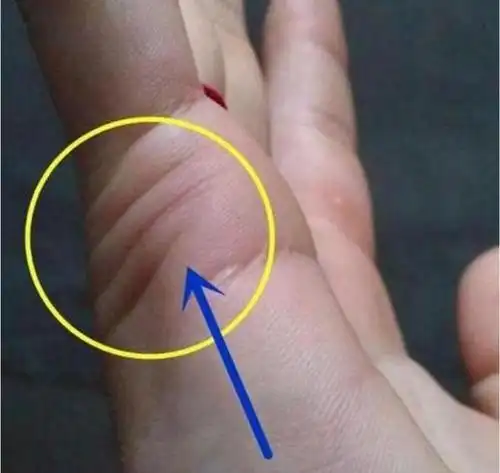 这种手相的男人"最穷"