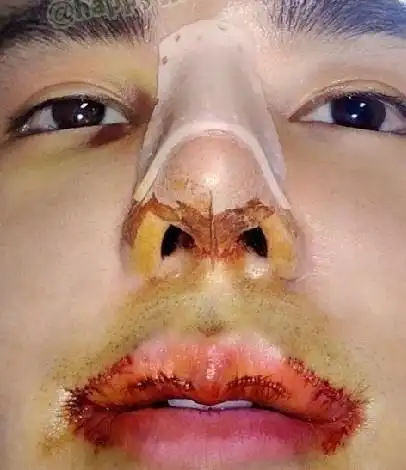 20130827明星韩国屌丝男辛酸整容史爆红大叔变美男