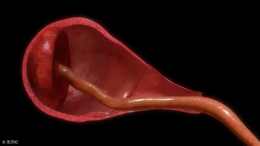 胎盘不光有成熟度,还有3种形状,哪种对胎宝宝最好?