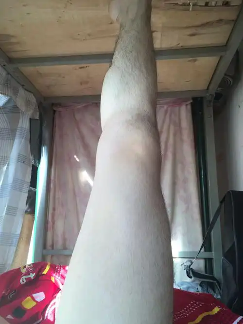 大腿小腿很粗 上半身很瘦 感觉是肌肉腿 有什么办法 真的超想瘦 只瘦