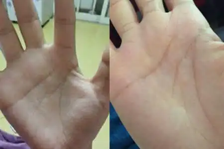 【图】婚姻线断开代表什么 为你分析其中寓意