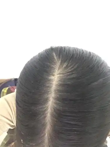 两天没洗了,头发薄成这样居然!我不要变秃子啊!哭唧唧