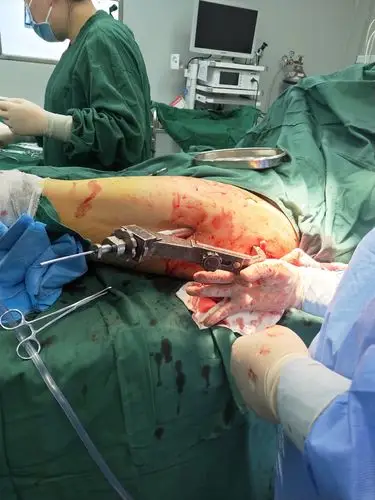 康秦医院外骨科迎来教授的第一天