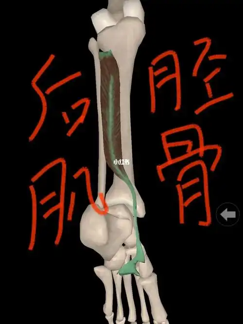 扁平足关键肌肉分享胫骨后肌