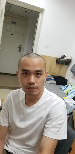 长的没以前快额角两侧已经开始有退化趋势这是18年5月剃寸头的照片