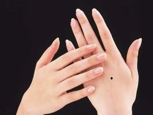 手背上有痣好吗