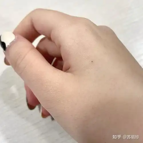 手背虎口处前两天突然长了一颗痣,有可能癌变吗?需要去做防癌检查吗?