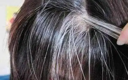 年纪轻轻就白发苍苍