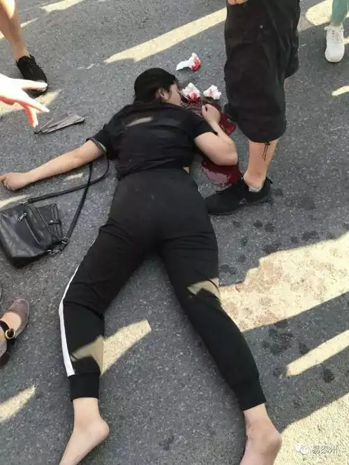 老牧校门口一年轻女子被撞飞两只小狗守在被撞主人身旁