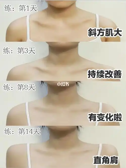 直角肩教程:消除斜方肌/拒绝溜肩虎背熊腰