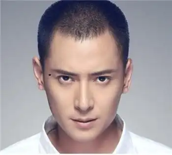 男人有这4颗痣,如散财童子下凡,花钱如流水,应尽早去除!