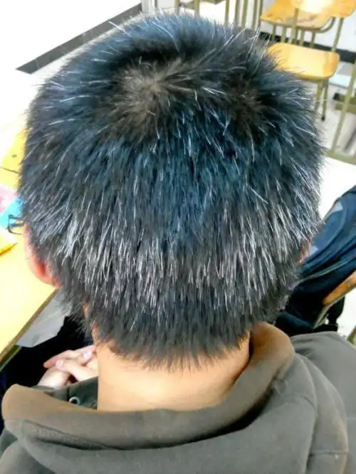 我们为什么会长白发?看完你就懂了|四川繁发盛世商贸有限公司