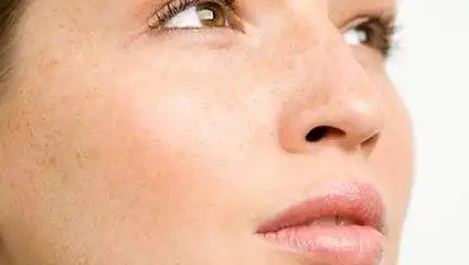 常州为什么皮肤会发黄?,常州专业祛疤