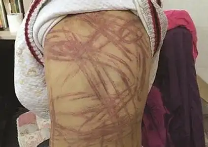 "虐童"事发后网上流传的照片之一.(资料图片)