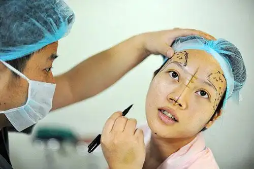 图为医生在小卓的脸上画线,准备对其进行第二次整容手术.