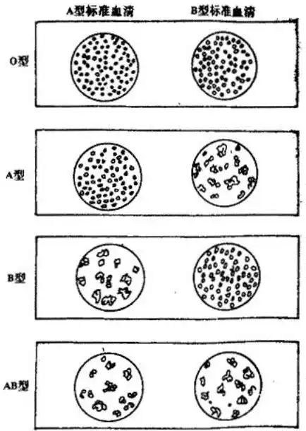 b型标准血清来检验,结果如下图所示:那么甲的血型是( )