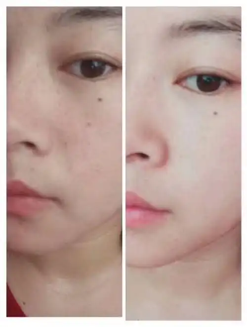 科普优弹素 优弹素改善皮肤干燥的原理: #优弹素 我们的皮肤有三层