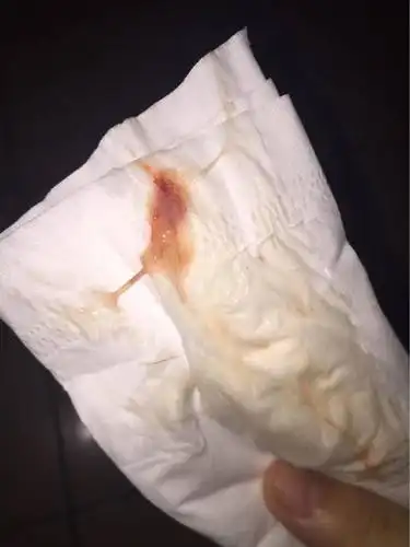 排卵期有哪些症状及其影响?