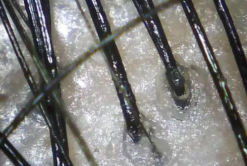 了解头发的皮囊