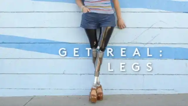 女孩生病失去了双腿,安装假肢后,依然每天穿高跟鞋,短裤出门!