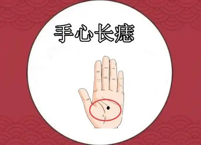 左手掌心虎口处的痣(左手掌心虎口处的痣代表什么)