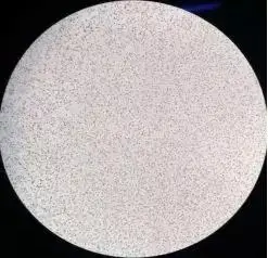 凝聚胺法交叉配血次侧凝集怎么破有图有真相